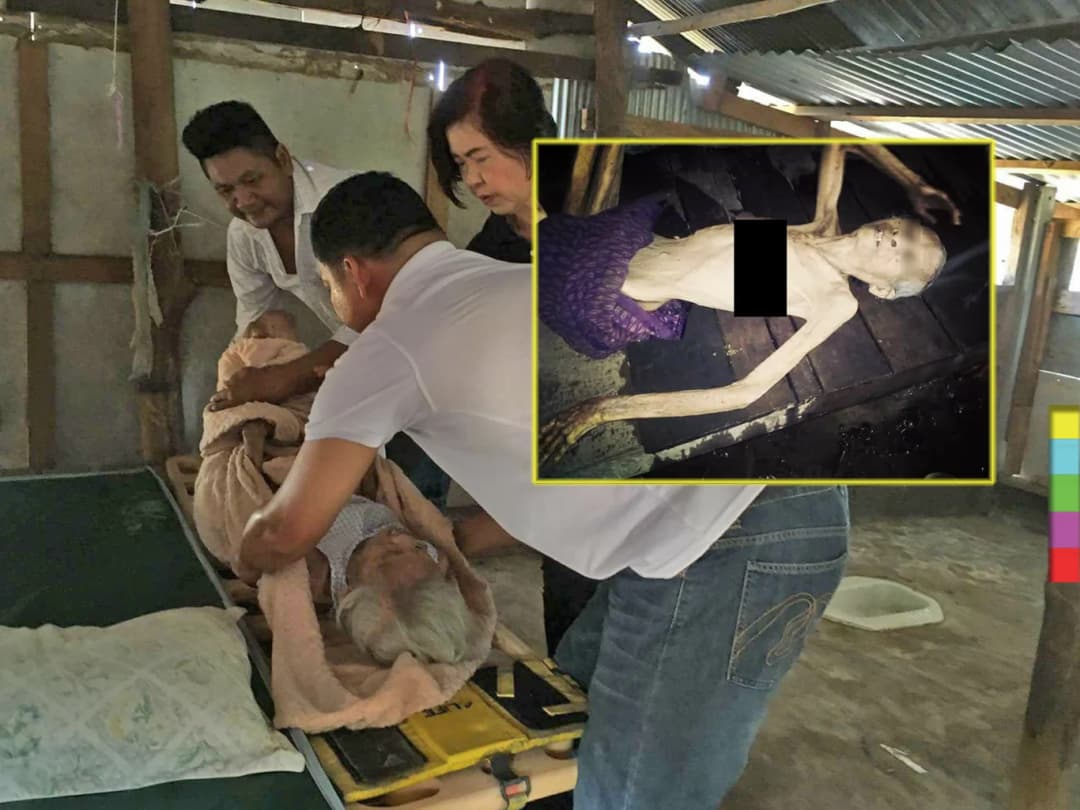 ดีใจ ! ‘ยายลูกชิ้น’ วัย 84 ป่วยเชื้อรากินกระดูก-ตาบอด มีคนมาช่วยแล้ว