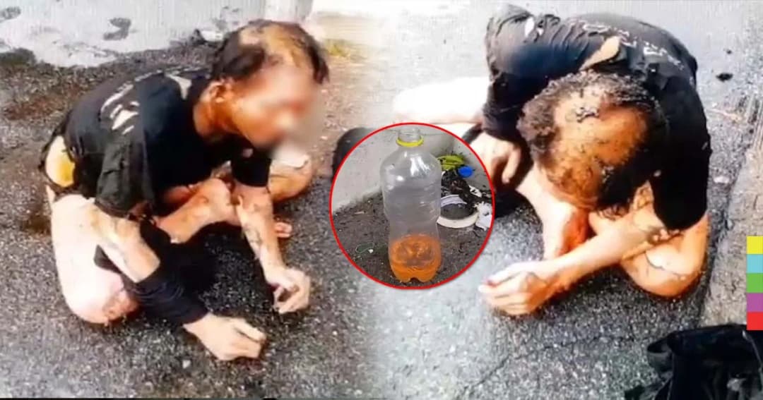 เกือบตาย ! หนุ่มใหญ่เครียดจัด คว้าขวดน้ำมันเบนซินราดตัวจุดไฟเผา อาการสาหัส