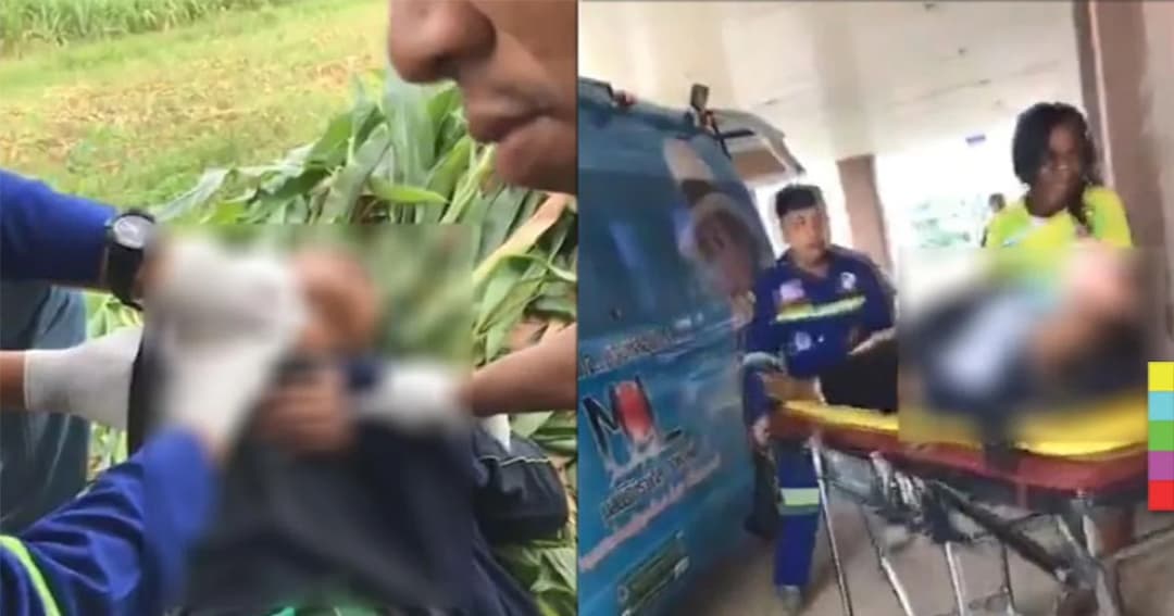 สยอง ! คนงานรับจ้างบดต้นข้าวโพด พลาด แขนเข้าไปในเครื่องโม่ ปั่นบดแขนขาดเกือบถึงไหล่