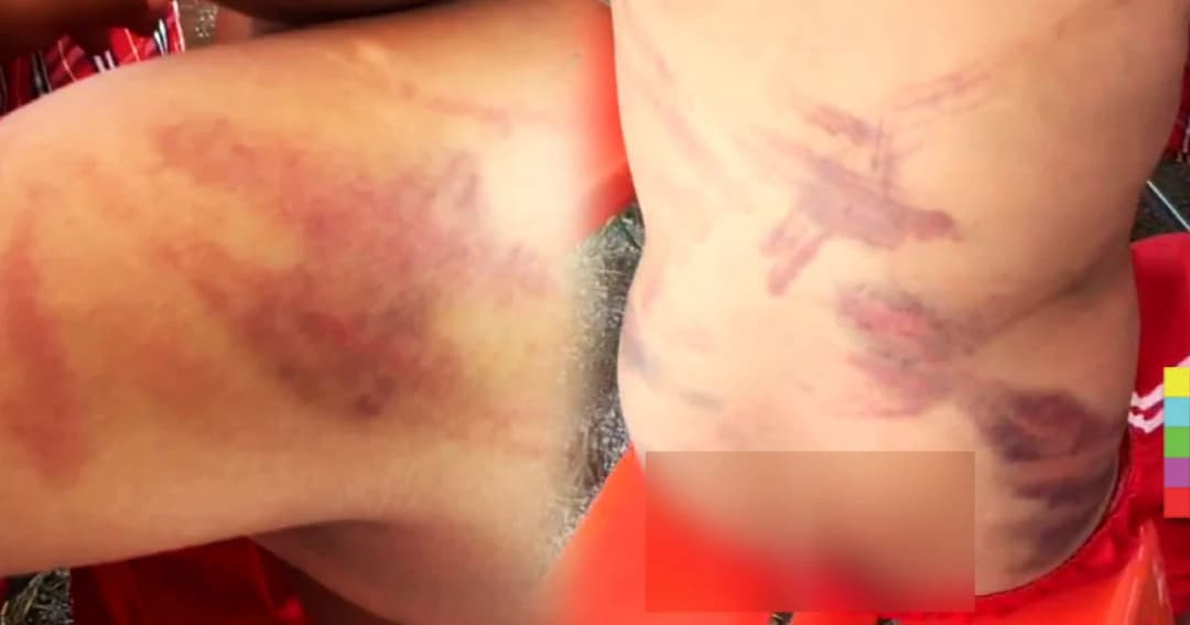 หนูน้อย ป.2 หนีพึ่งวัด พ่อแม่แท้ๆ ตีจนช้ำระบม