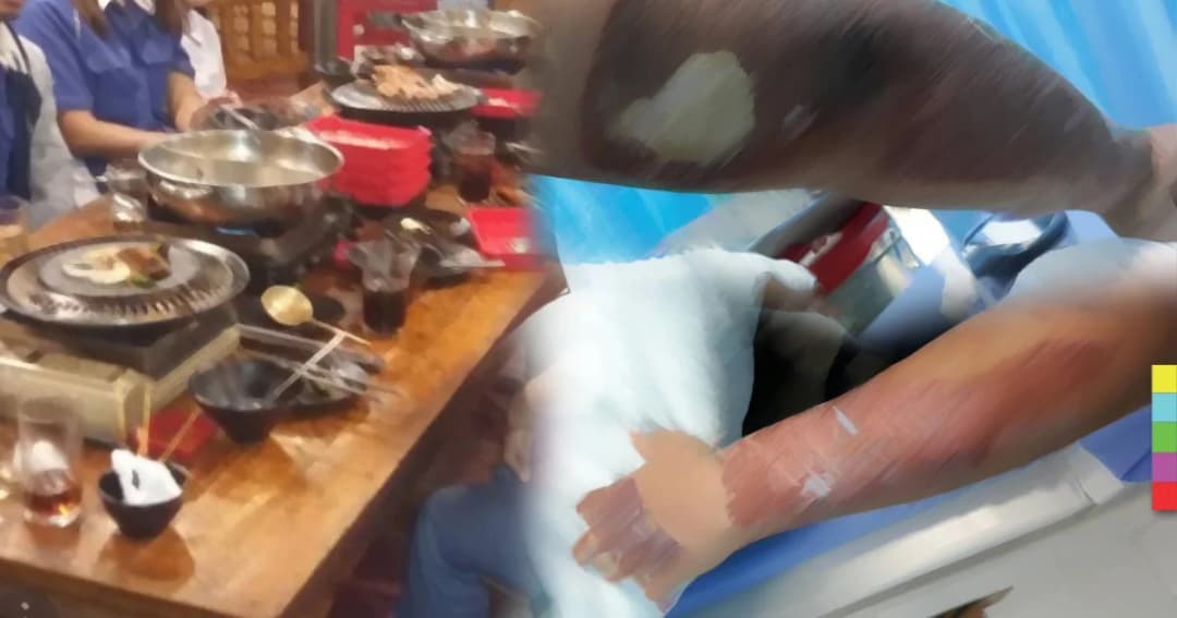 ร้องทุกข์ ! เหยื่อแก๊สกระป๋องร้านปิ้งย่างระเบิด ไม่พอใจเงินเยียวยาคู่กรณี – คดีไม่คืบ