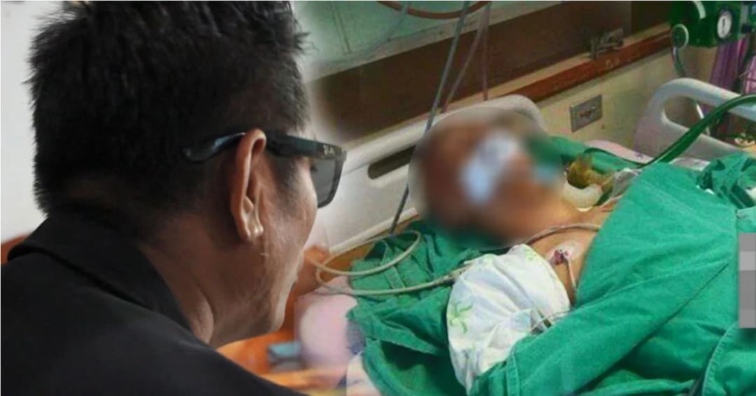 พ่อร้องสื่อ ลูกชายวัย 15 ปี ถูกการ์ดผับดัง ทำร้ายร่างกาย จุดไฟเผา อาการโคม่า