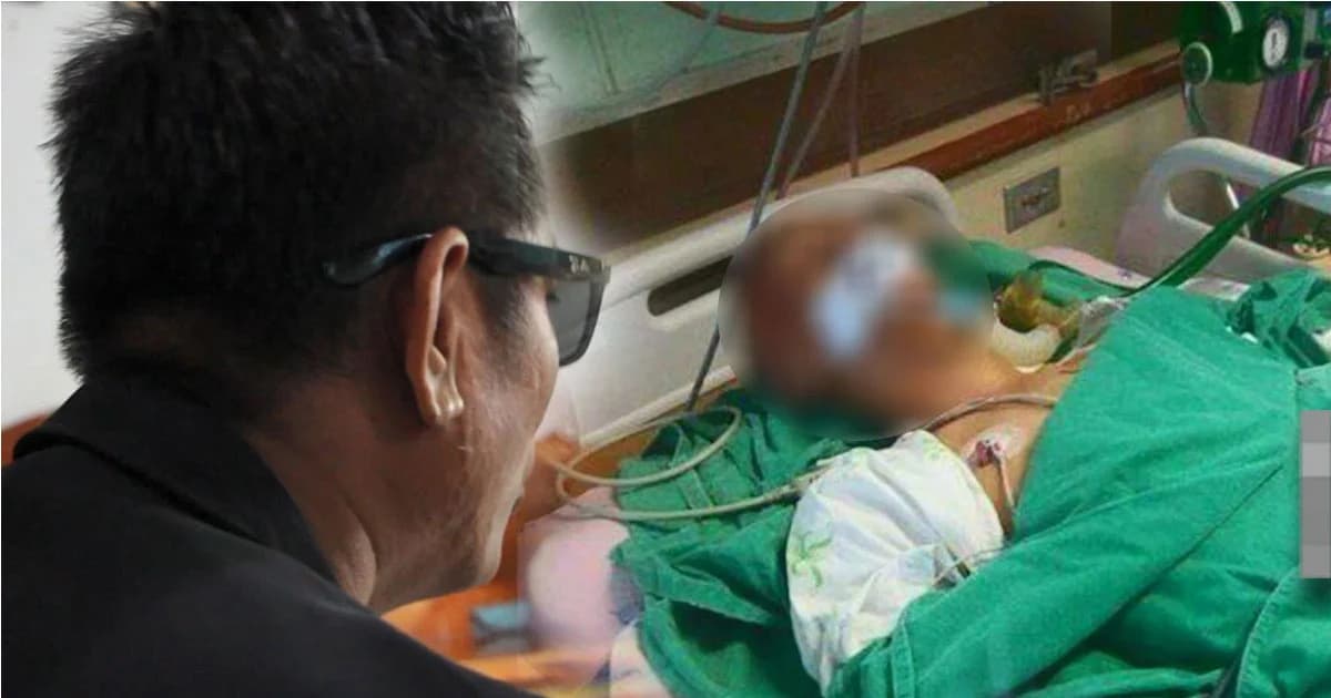 พ่อร้องสื่อ ลูกชายวัย 15 ปี ถูกการ์ดผับดัง ทำร้ายร่างกาย จุดไฟเผา อาการโคม่า
