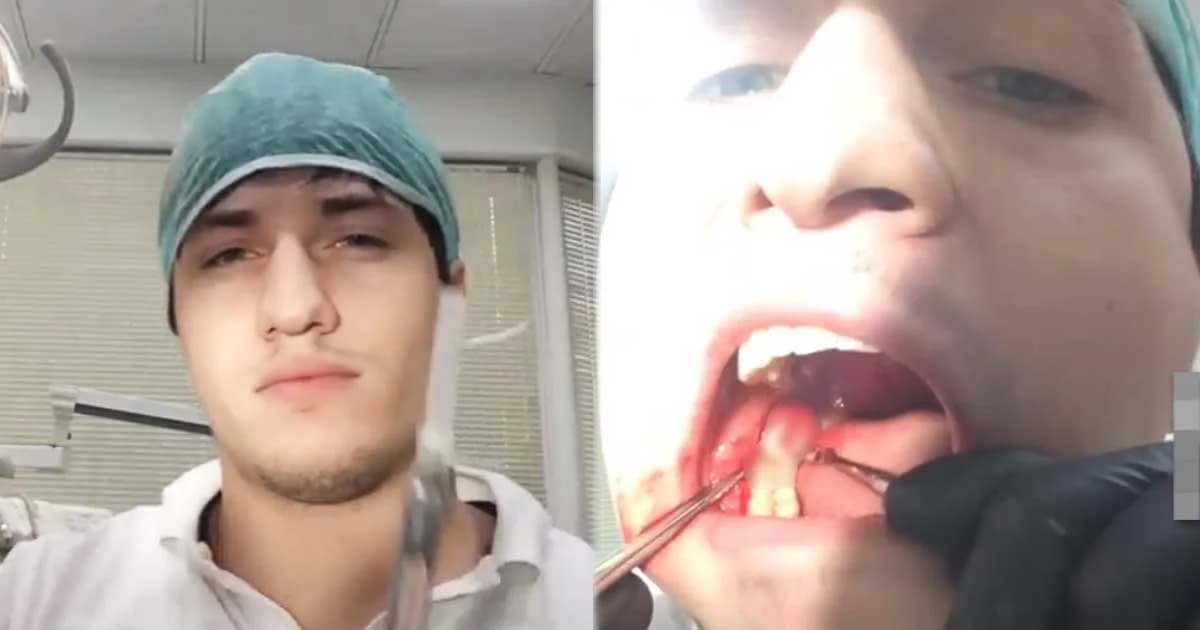 หมอฟันหนุ่มปวดฟันคุดหนัก โชว์ทักษะถอนฟันด้วยตัวเอง