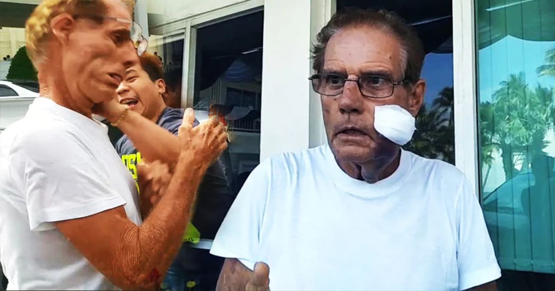 คืบหน้า ! ชาวต่างชาติ คว้าอีโต้ฟันหนุ่มร้านทอง ก่อนถูกชกร่วง เจอเเจ้งข้อหาพยายามฆ่า