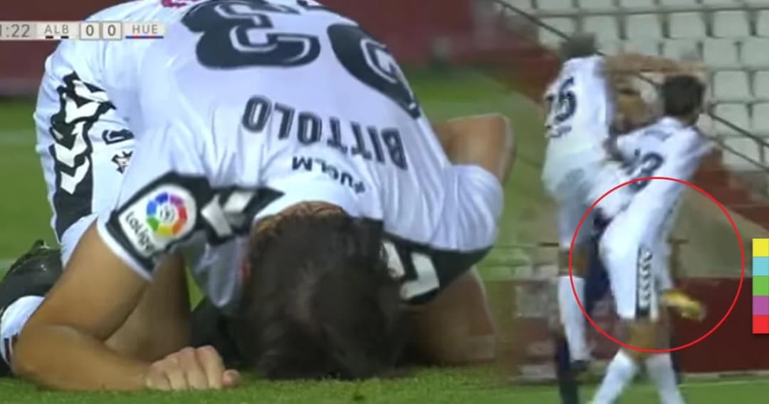 นักเตะ ‘อัลบาเซเต้’ ถูกสตั๊ดเพื่อนเตะ ‘น้องชายสุดรัก’ อย่างจัง ต้องเย็บถึง 10 เข็ม !