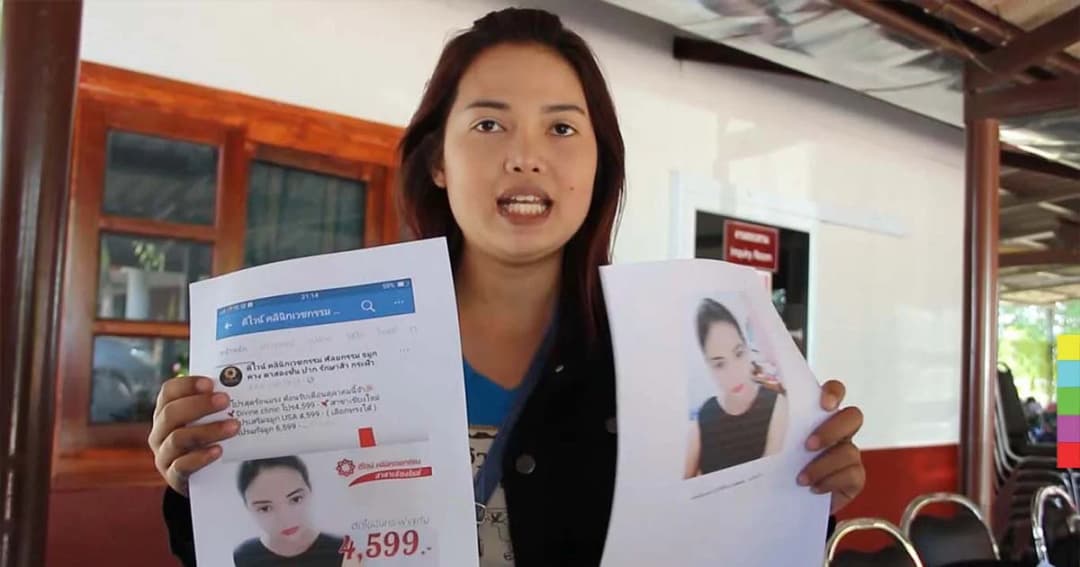 โผล่อีกราย ! สาวแจ้ง ตร. เอาผิดคลินิกเสริมความงามลำปาง หลังทำคางแล้วเน่า