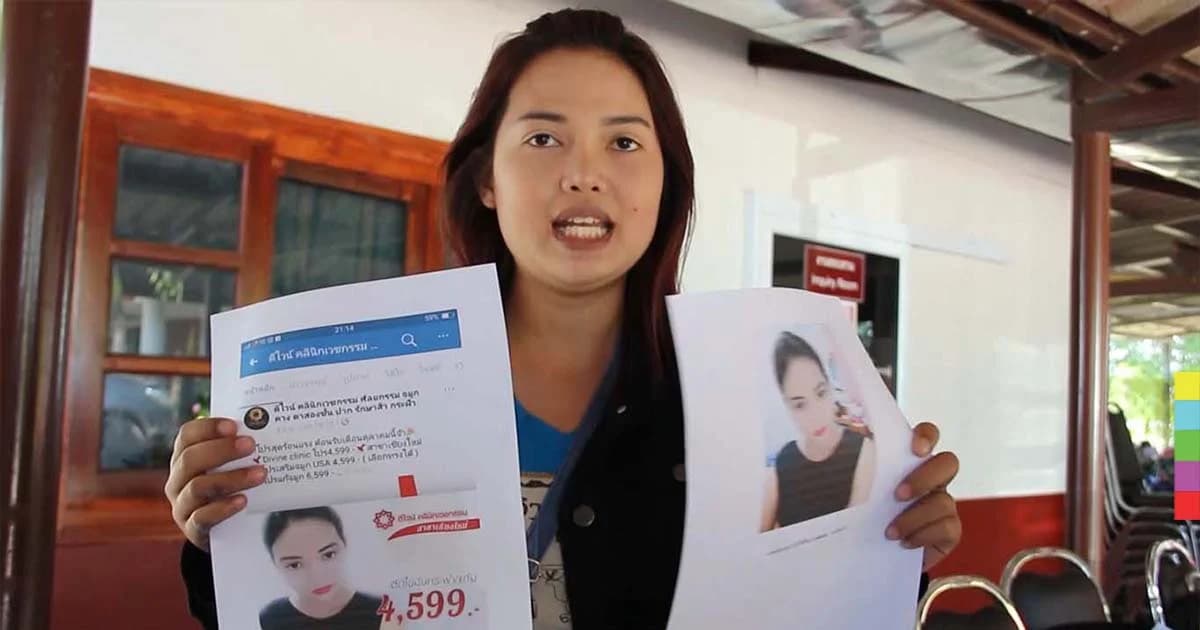 โผล่อีกราย ! สาวแจ้ง ตร. เอาผิดคลินิกเสริมความงามลำปาง หลังทำคางแล้วเน่า