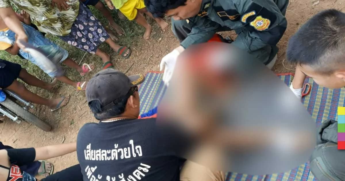 หวาดเสียว ! เด็ก 7 ขวบ เล่นพลาดท่าถูกไม้เสียบอัณฑะทะลุ