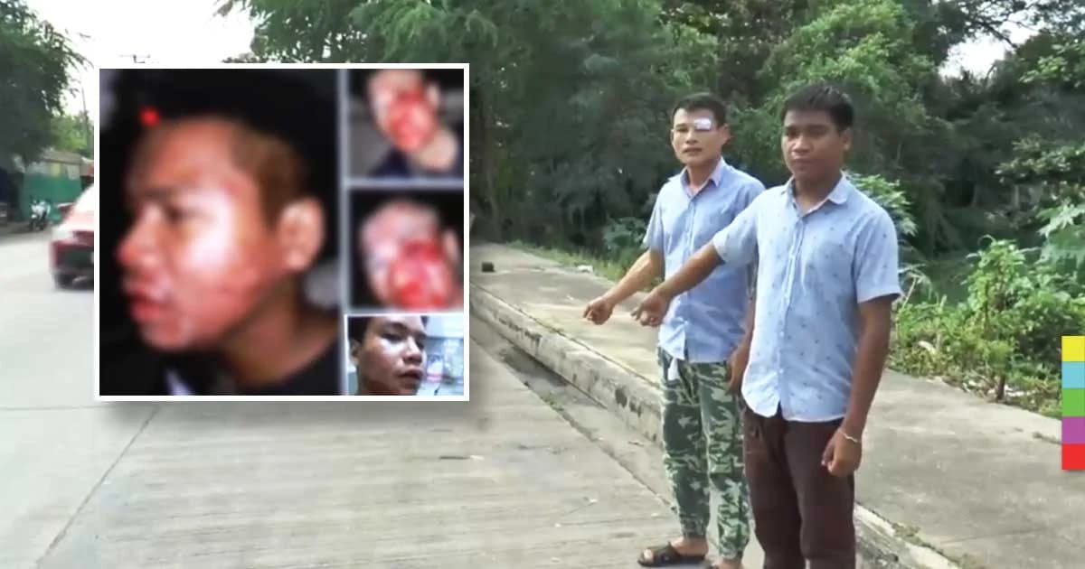 โจรเหี้ยมตามประกบ จยย.สามพี่น้อง ชกหน้าแหกหวังไถเงิน 500 บาท