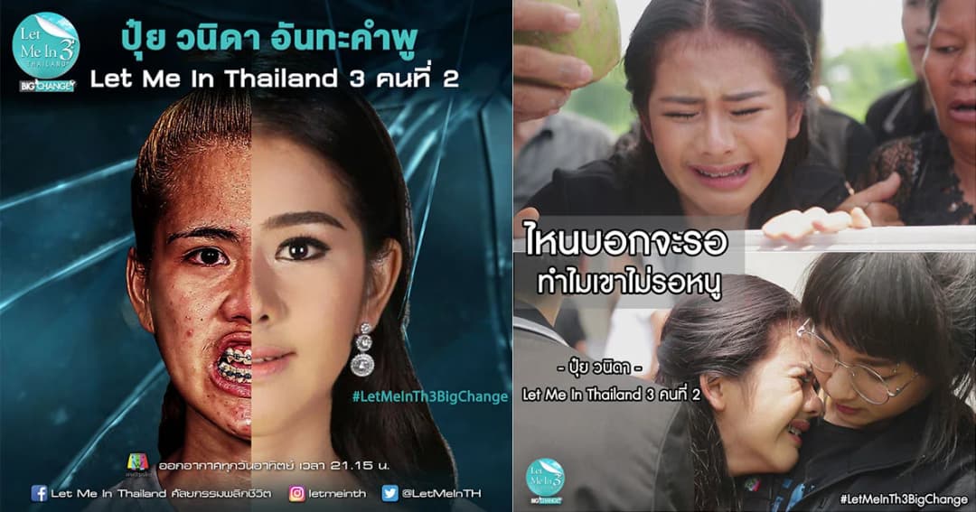 ชีวิตจริงยิ่งกว่าละคร “ปุ๋ย วนิดา” Let Me In Thailand 3 คนที่ 2