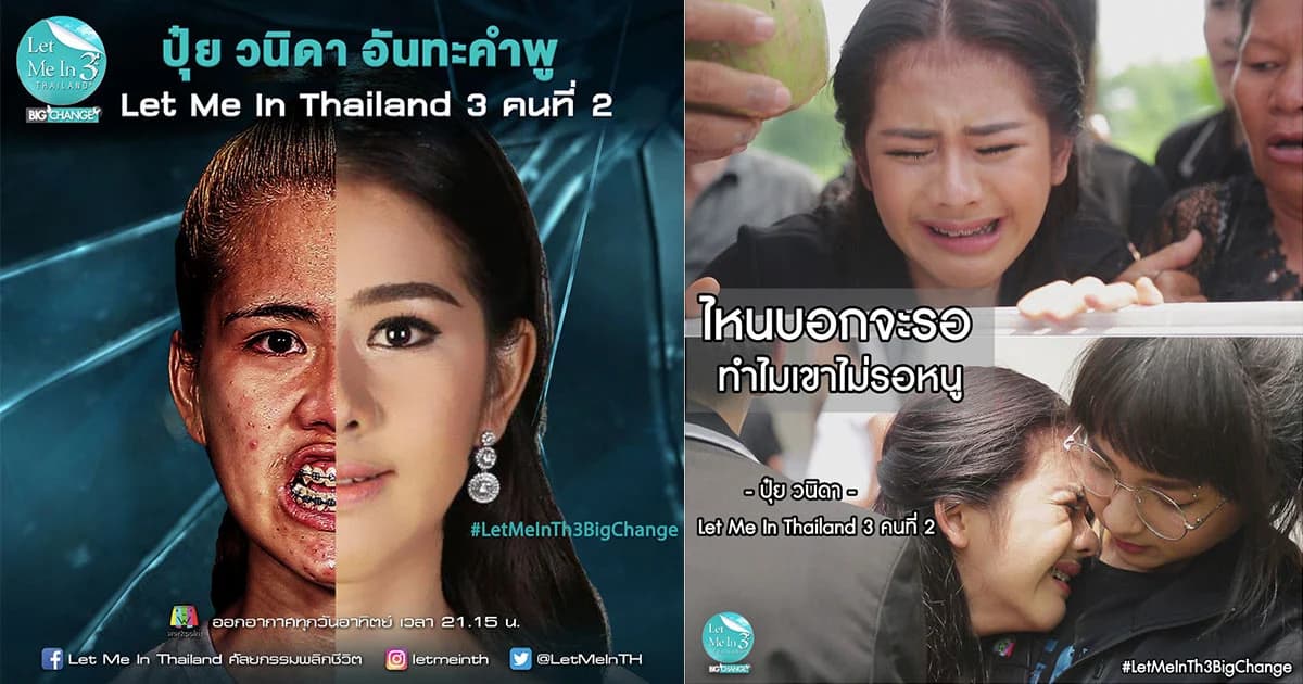 ชีวิตจริงยิ่งกว่าละคร “ปุ๋ย วนิดา” Let Me In Thailand 3 คนที่ 2