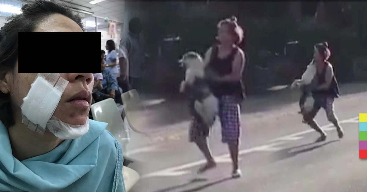 ชาวเน็ตชื่นชม ! สาวอุ้มสุนัขโดนรถชน แต่ถูกแว้งกัดหน้า เย็บ 8 เข็ม
