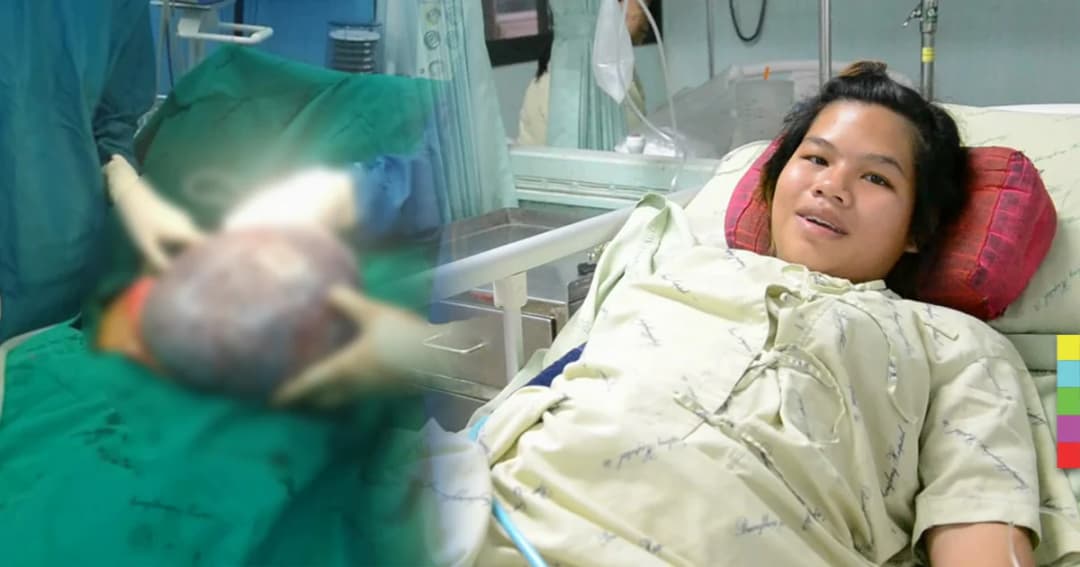 สาวท้องโตนึกว่าลูกแฝด ที่แท้พบเนื้องอกรังไข่หนักกว่า 4.2 กิโลกรัม