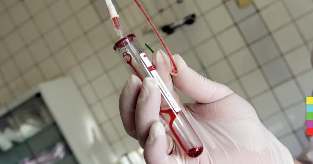 HIV ระบาดเพิ่มในรัสเซีย ส่วนหนึ่งเพราะมีความเชื่อเป็นเรื่องโกหก