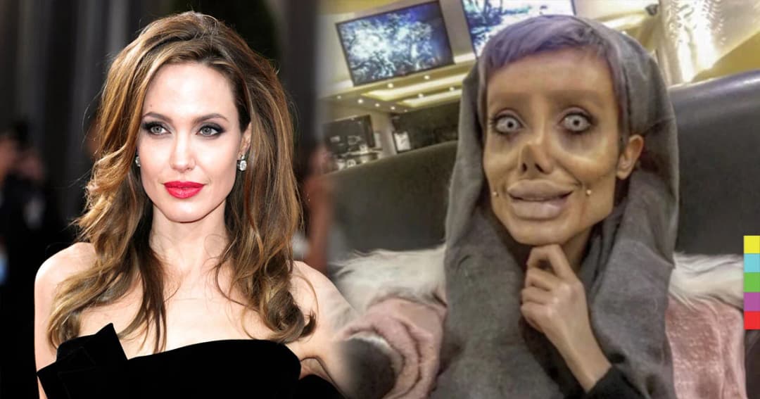 สาวอิหร่าน ศัลยกรรมหน้า 50 ครั้ง ขอสวยเหมือน ‘แองเจลินา โจลี’