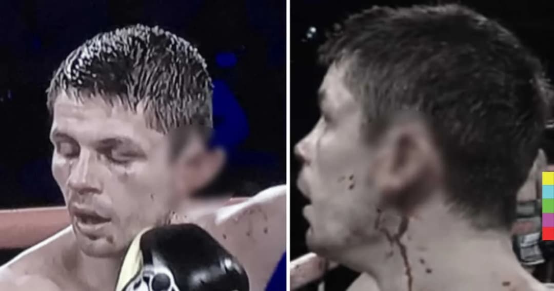 หวาดเสียว ! มวยโลกดวลกำปั้นกัน จนใบหูหวิดขาด