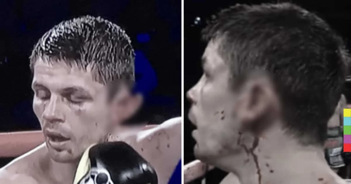 หวาดเสียว ! มวยโลกดวลกำปั้นกัน จนใบหูหวิดขาด