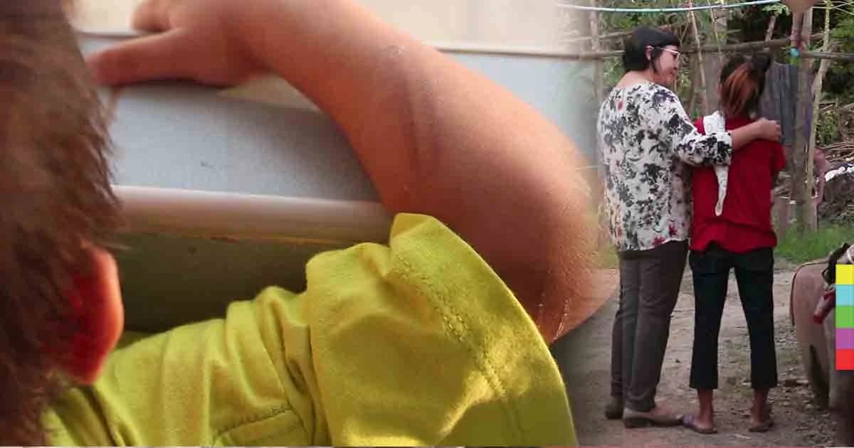 สุดเวทนา ! พม.เข้ารับตัวเด็กชายวัย 2 ขวบ หลังโดนทำร้ายกาย