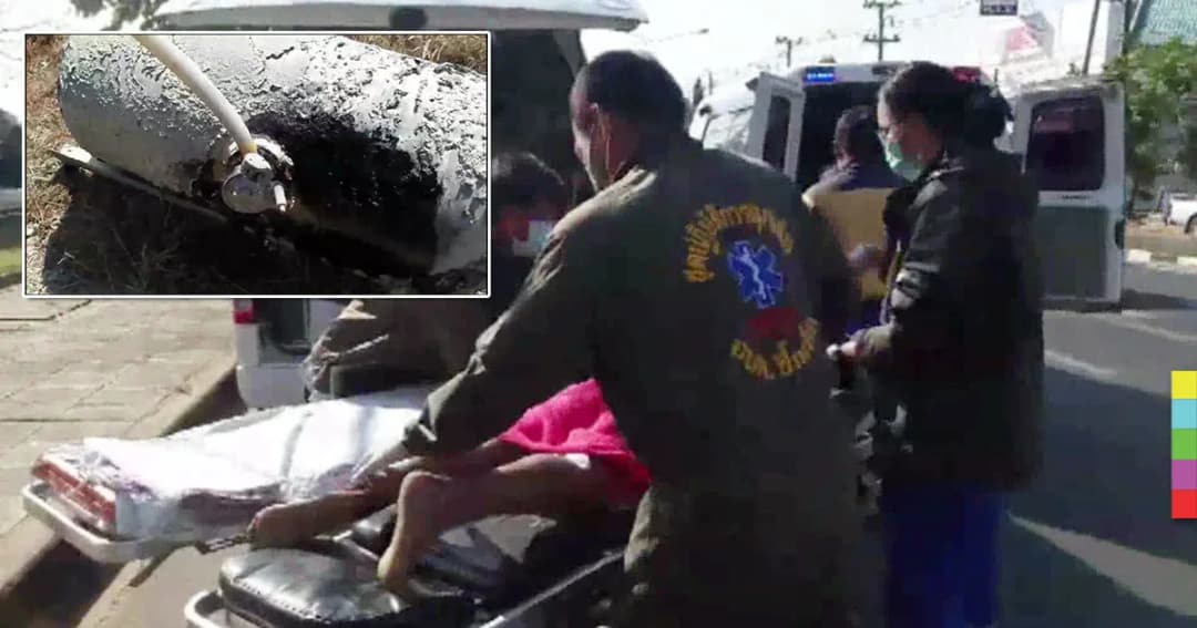 ระวัง ! งัดถังแก๊ส LPG รั่วติดไฟลวก 2 สามีภรรยา เจ็บหนัก