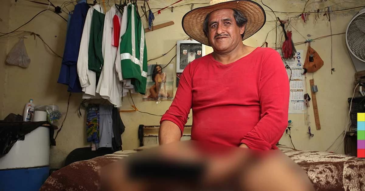 หนุ่มจู๋ใหญ่สุดในโลกหางานไม่ได้ ขอรับเบี้ยคนพิการ