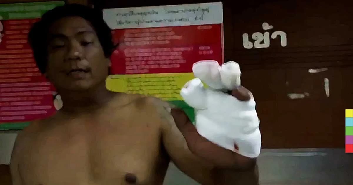 หนุ่มเมืองคอนจุดประทัดฉลองปีใหม่ ระเบิดใส่มือนิ้วเกือบขาด