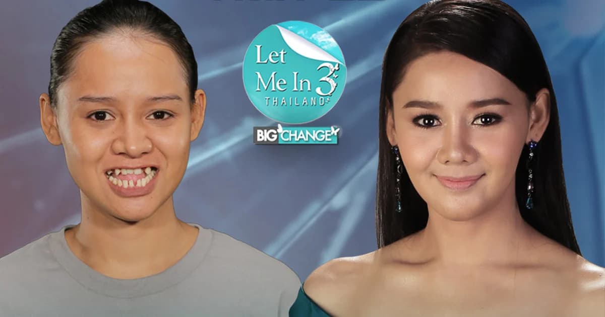 Let Me In Thailand 3 คนที่ 12 รักอาชีพ “ครู” แม้หน้าตาไม่เอื้ออำนวย