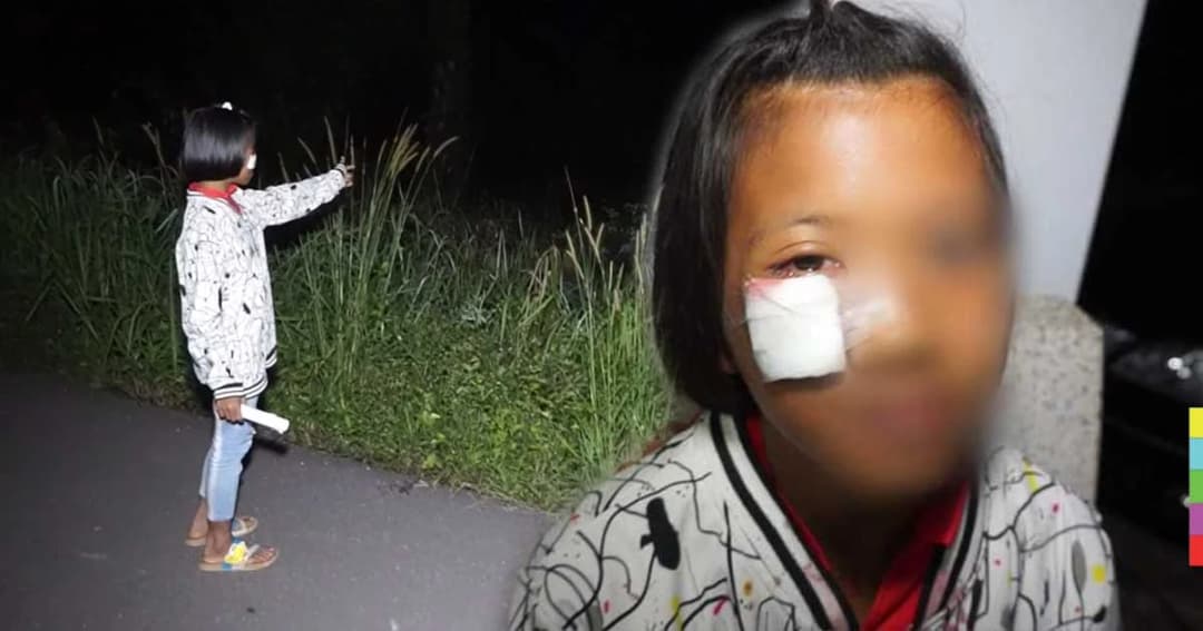 จิตใจทำด้วยอะไร ! คนร้ายดักข้างทางยิงหินใส่ตา ด.ญ.วัย 12 ปี เย็บ 5 เข็ม