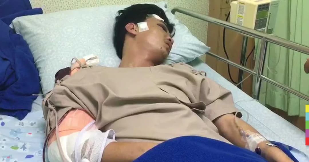 หนุ่มดวงแข็งรอดตาย ปัดเซลฟีคู่รถไฟ ยันไม่ได้เมา