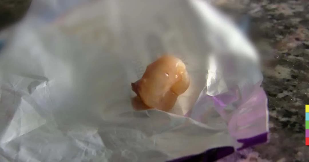 แทบอ้วก! หนุ่มใหญ่อ้าง เจอฟันกรามมนุษย์ ในไอศกรีมชื่อดัง