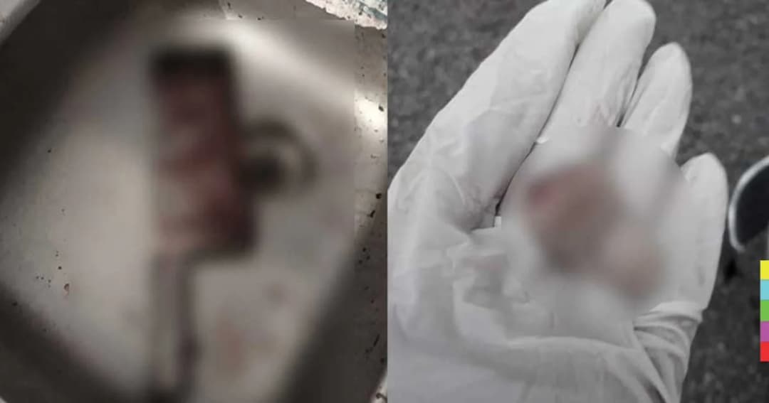 ผัวช็อก ! เมียป่วยโรคประสาทอยู่บ้านคนเดียว คว้ามีดอีโต้ฟันนิ้วขาด