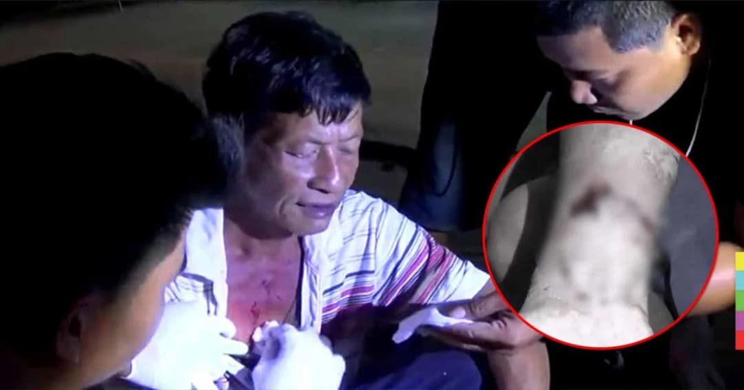 สุนัขพันธุ์ไทยคลั่ง ! ขย้ำเจ้าของเป็นแผลเหวอะ หวั่นติดเชื้อพิษสุนัขบ้า