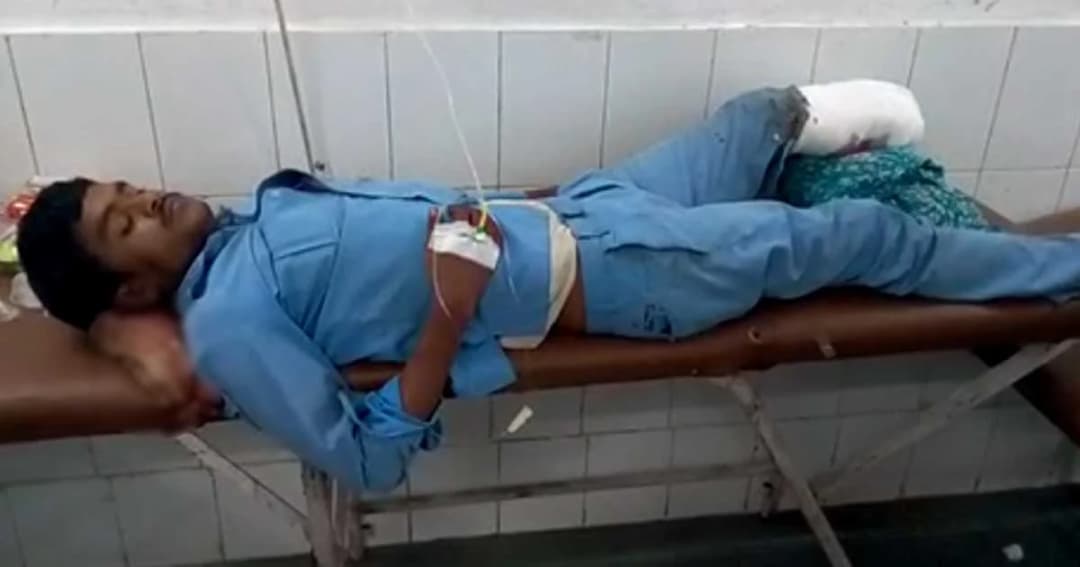 คิดได้ไง! หมออินเดียตัดขาคนไข้รถคว่ำ ก่อนให้หนุนแทนหมอน