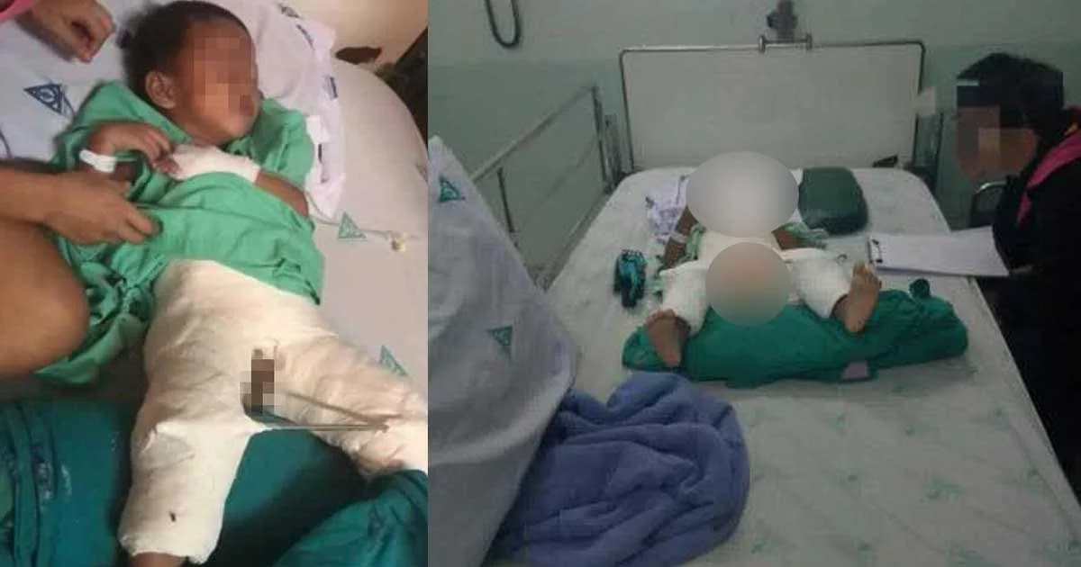 รวบพ่อเลี้ยงโหด ทุบลูกน้อย 2 ขวบขาหัก โมโหฉี่รดที่นอน