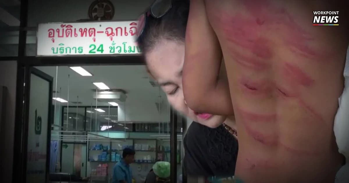 พ่อเลี้ยงโหด ตีเมีย–ลูกเลี้ยงสองคนเนื้อแตกสาหัส