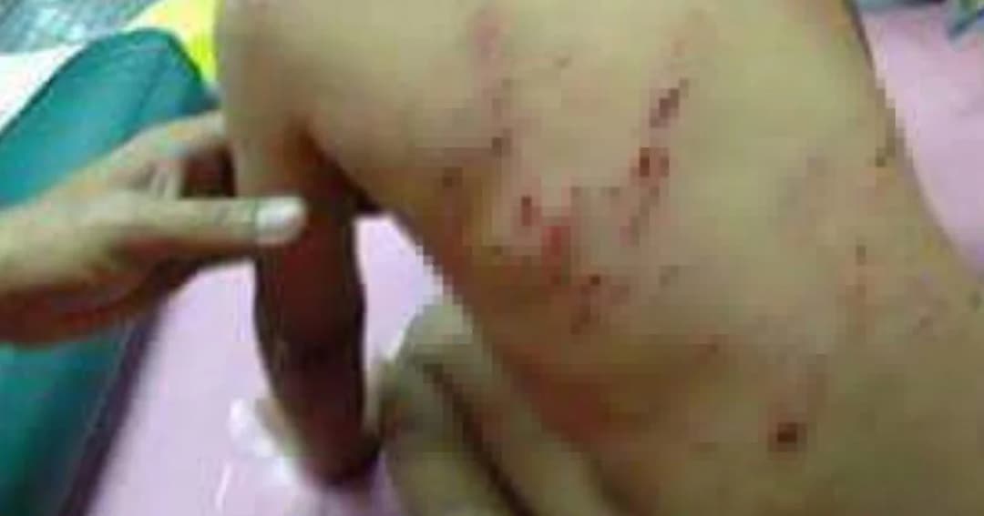 เด็กชายถูกสุนัข 6 ตัวรุมกัดแผลเหวอะ ขณะคนให้อาหารสุนัขเงียบกริบ