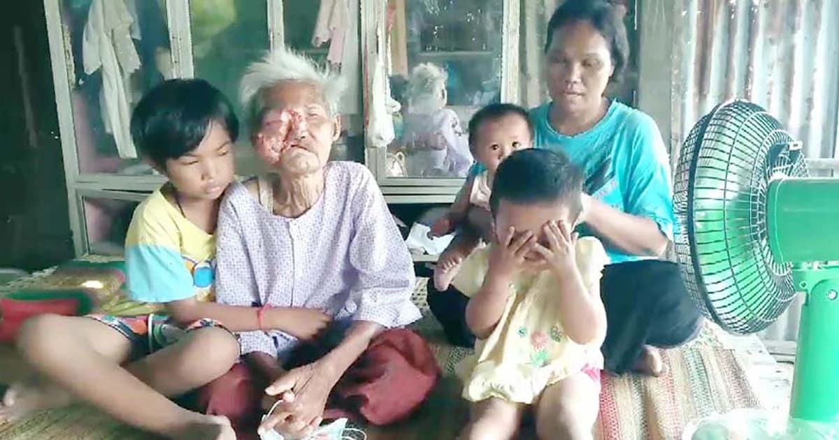 วอนช่วยคุณยายป่วยหนัก ไม่มีเงินไปหาหมอ