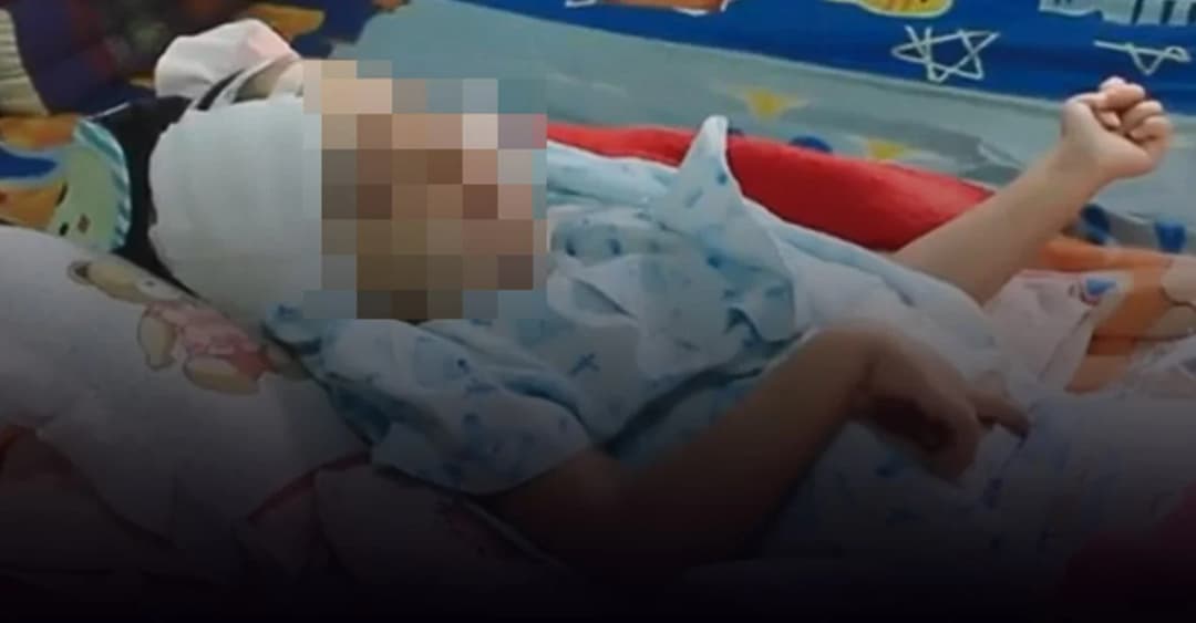 เด็กหญิงวัย 3 ขวบ ถูกแม่ทำร้าย จนเป็นเจ้าหญิงนิทรา