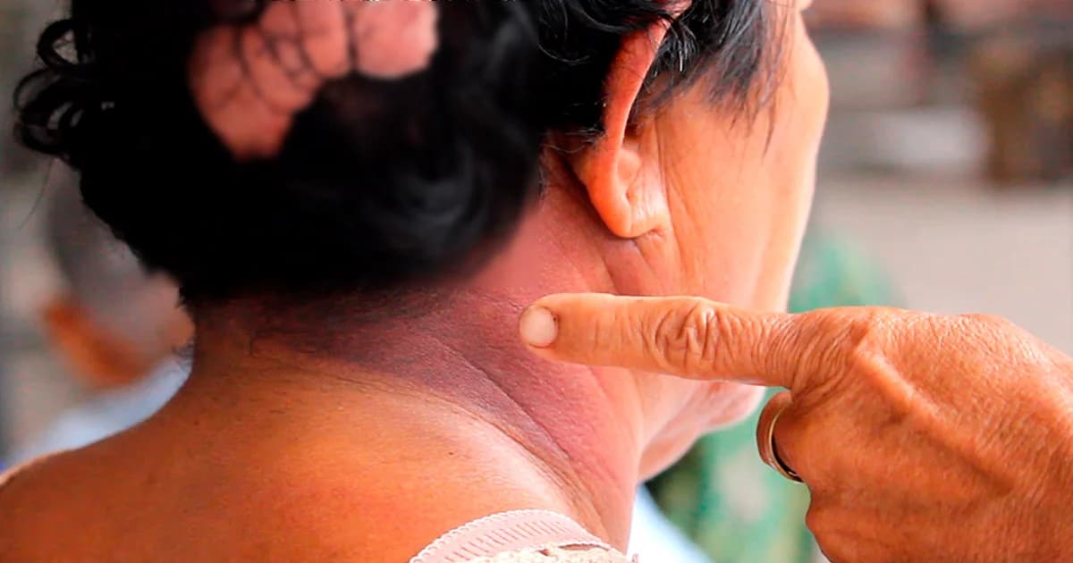 โจรแสบตีสนิท ขอเข้าห้องน้ำทุบหัวเหยื่อชิงทรัพย์หนีลอยนวล