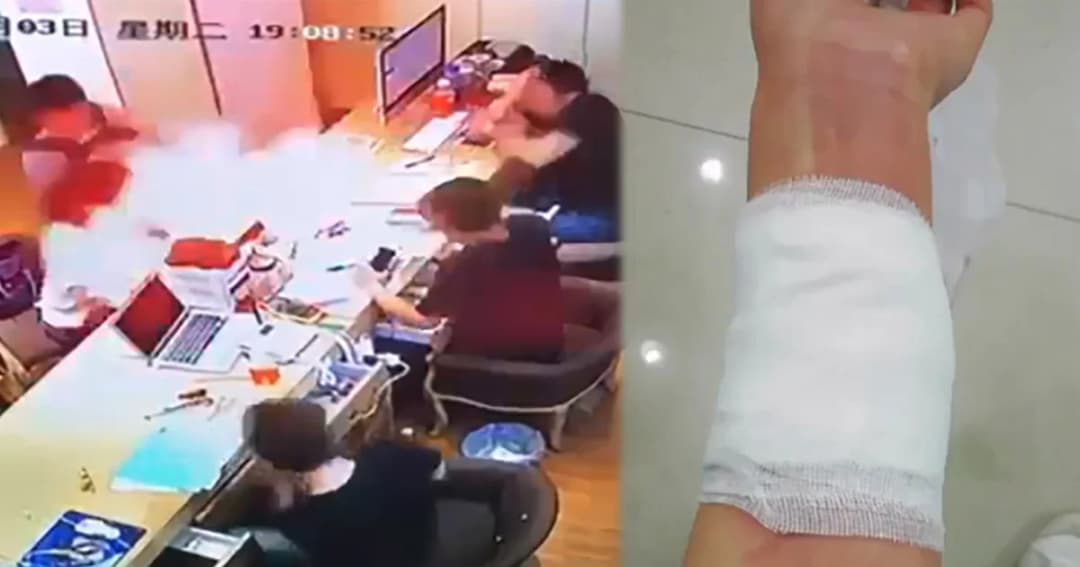 แบตไอโฟนระเบิดคาร้านเถื่อนในจีน อ้างเป็นศูนย์แอปเปิล ลูกค้าเจ็บ