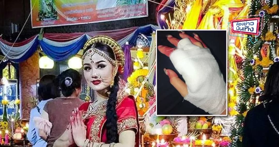 น่ากลัว! “กระแต อาร์สยาม” ถูกไฟไหม้มือ หลังรำแก้บน