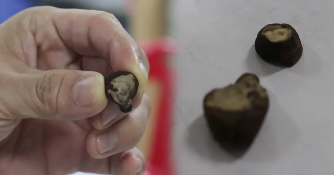 ชาวบ้านดื่มสุราดองรากไม้ หามส่ง รพ. แพทย์ชี้หวั่นไตวาย