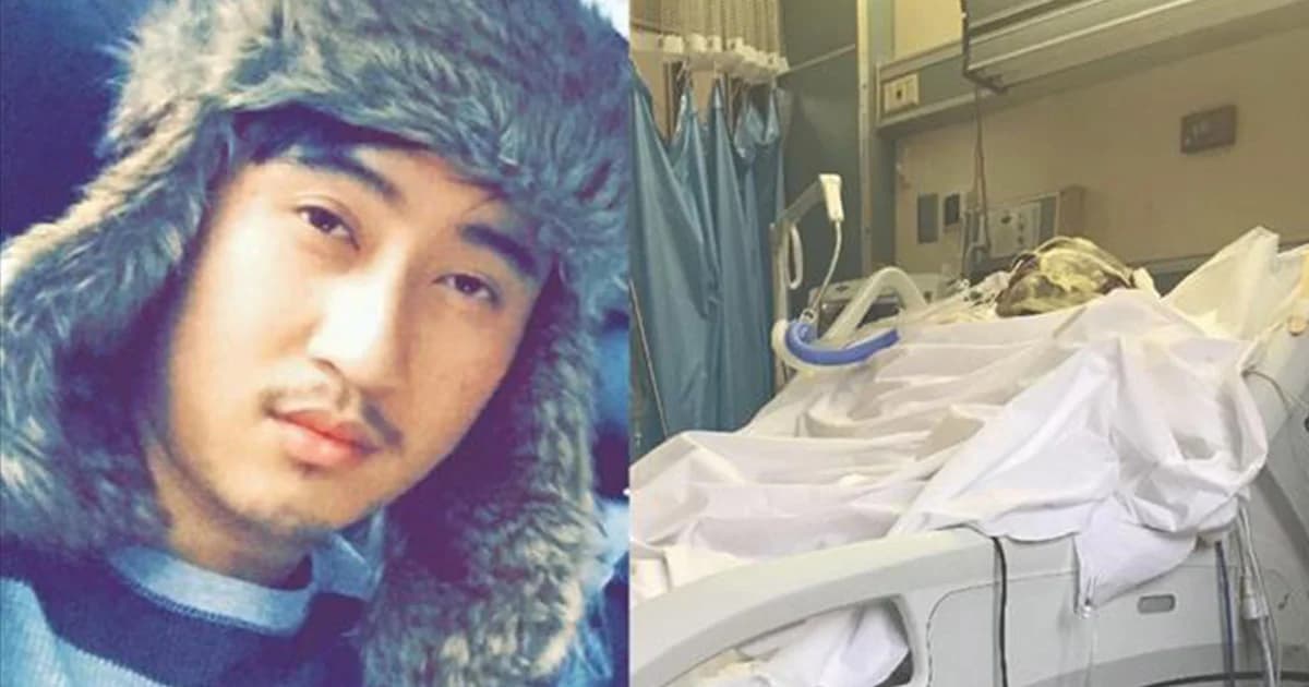 หนุ่มไทยในสหรัฐฯ ถูกคนร้ายบุกสาดน้ำกรด อาการสาหัส ตาบอดสนิท