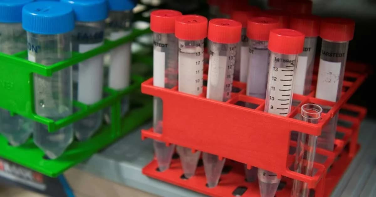 ญี่ปุ่นเตรียมทดลองตรวจหามะเร็งจาก “ปัสสาวะ”