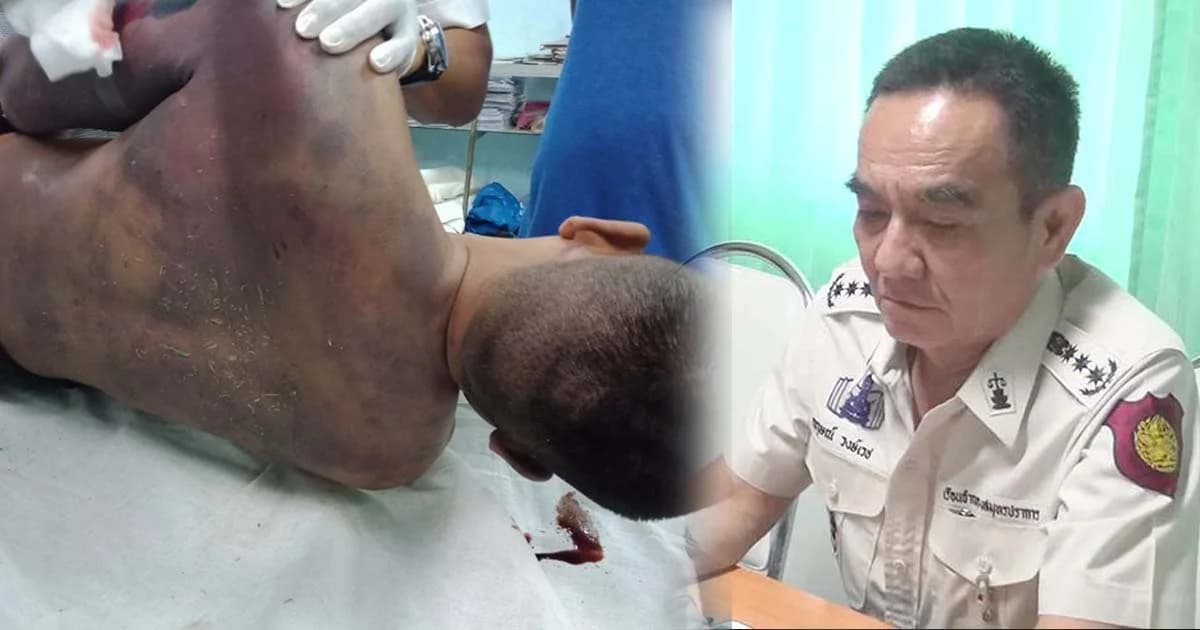 ร้อนเรือนจำ ! ตั้งกรรมการสอบผู้ต้องขังตายคาเรือนจำ