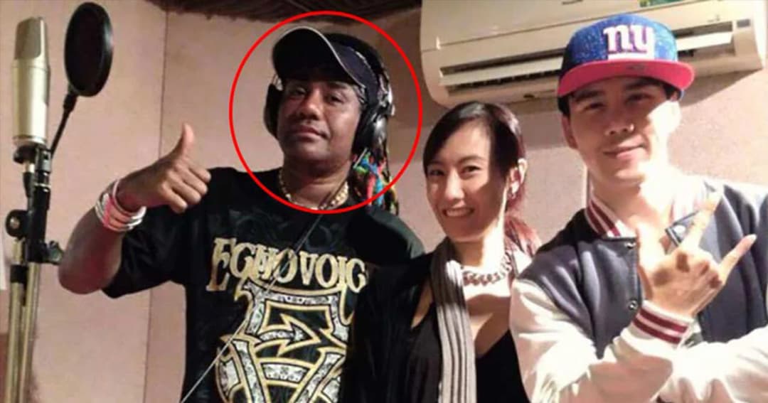 โจอี้ บาซู มีอาการอัมพาตซีกขวา แพทย์ชี้ เนื้อสมองบวม