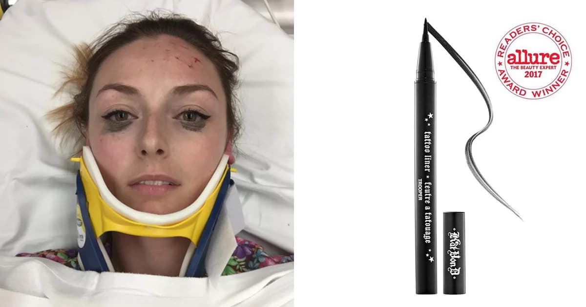 ของดีจริง ! สาวถูกรถชนเจ็บหนัก แต่อายไลเนอร์ยังติดทนนาน