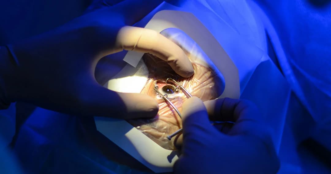 สธ.วอน ช่วยกันบริจาคดวงตา-อวัยวะ ต่อชีวีตเพื่อนมนุษย์