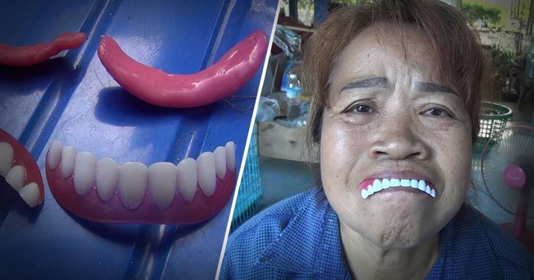 ป้าโวย ! สั่งซื้อฟันปลอมทางเฟซฯ กลับใส่ไม่เข้า