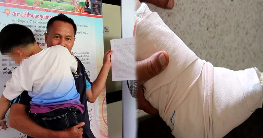 สาธารณสุขเร่งตวจสอบ กรณี รพ.ไร้แพทย์ไม่ต่อเอ็นเด็ก 5 ขวบ เย็บแผลให้อย่างเดียว